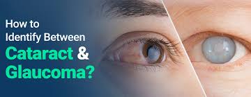 Image result for Cataract