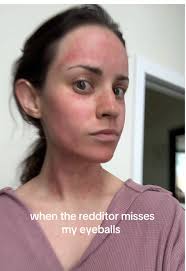 get these boys some pineapple stat