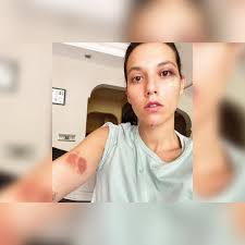 Medya Adami Auf Twitter Cene Ucunda 1 0 3 Cm Yara Kafasina Vurulmayla Sol Gozde Morarma Sol Kolda 5 Cm Sag Kolda 6 Cm Morarma Vucutta Kesikler Sen Ozan Guven I