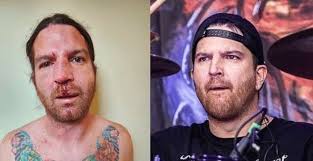 VULVODYNIA drummer TOM HUGHES gives more detail