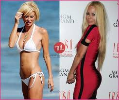 Pin On Plastic Surgery 2
