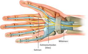 Sehnenscheidenentzundung Gesundheitsinformation De