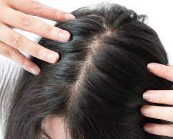 Help for dry hair problem: Thin Dry Frizzy Menopause Hair Oh My Lisa Health Blog