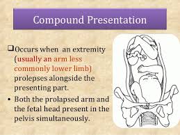 Image result for Compound Presentation