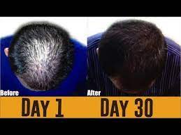 These Foods Will Stop Hair Fall Immediately Complete Hair Nutrition Foods List Hindi Youtube Hair Nutrition Hair Nutrition Food Hair Fall Problem