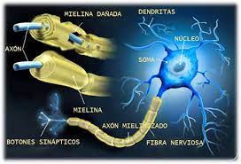 Las personas experimentan síntomas diferentes en momentos distintos. Esclerosis Multiple Revision Farmacologica