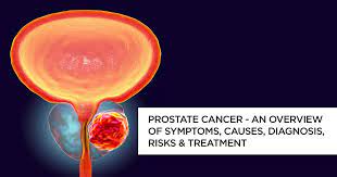 One in seven men in the united states will receive a prostate cancer diagnosis during his lifetime. What Is Prostate Cancer Prostate Cancer Symptoms And Treatment