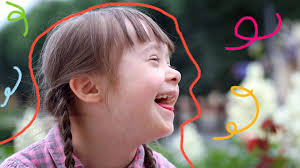 Se trata de un trastorno genético causado por una división celular anormal en la que se produce una copia extra o parcial del cromosoma 21. Acolhimento Video Explica A Sindrome De Down Para As Criancas