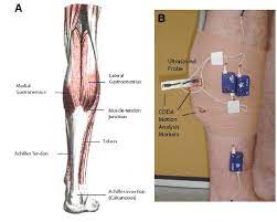 A muscle strain is a stretch or tear of muscle fibers. A Anatomy Of The Triceps Surae Muscle Group And The Achilles Tendon Download Scientific Diagram