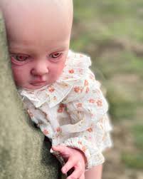 pls visit the Original post 🙏🏽🥹