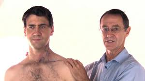 Sternocleidomastoid Syndrome And Trigger Points Physiopedia