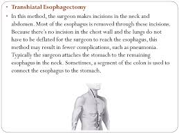 • right vats, laparotomy and neck incision • laparotomy for gastric mobilization, thoracoscopic esophagectomy. Ø¨Ù‡ Ù†Ø§Ù… Ø®Ø§Ù„Ù‚ Ù‡Ø³ØªÛŒ Esophageal Cancer Ø§Ø¹Ù…Ø§Ù„ Ø¬Ø±Ø§Ø­ÛŒ Ù†ÙˆÛŒÙ† Ø¯Ø± Ú©Ø§Ù†Ø³Ø±Ù‡Ø§ÛŒ Ù‚Ø³Ù…Øª Ù‡Ø§ÛŒ Ù…Ø®ØªÙ„Ù Ù…Ø±ÛŒ Ø¯Ú©ØªØ± Ù¾Ø±ÙˆÛŒØ² ÙÙ„Ø§Ø­ Ø¹Ø§Ø¨Ø¯ Ø¯Ø§Ù†Ø´ÛŒØ§Ø± Ø¯Ø§Ù†Ø´Ú¯Ø§Ù‡ Ø¹Ù„ÙˆÙ… Ù¾Ø²Ø´Ú©ÛŒ Ù‚Ø²ÙˆÛŒÙ† Ppt Download