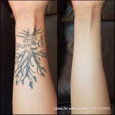 50 Pigmentation Makes A Difference This Tattoo Cover Up Required Only Concealer 03 Perfect Foundation O Natural Cosmetics Quality Makeup Tattoo Cover Up