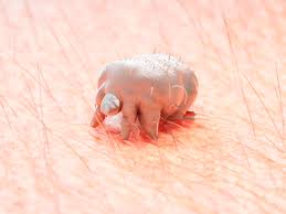 The scabies mite causes an itchy skin rash. Yyjllu Kuob0xm