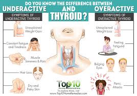 Keletihan, penurunan berat badan, keguguran dan keguguran rambut adalah beberapa gejala yang diketahui yang menunjukkan disfungsi tiroid. 11 Fakta Thyroid Tumor Tiroid Yang Dihadapi Thalita Latief