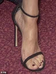 Meghan Markle Shows Off Dark Toenail Polish And Rumored Bunion Scar Princess Diana Funeral Beautiful High Heels Meghan Markle