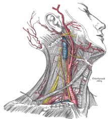 The material blocking the artery (plaque) will be removed by the vascular surgeon. Common Carotid Artery Wikipedia