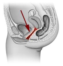 A few years ago, monty wrote an article called what does a normal vagina look like? Vulva Was Du Uber Die Vulva Einer Frau Unbedingt Wissen Musst 8 Facher Weiblicher Orgasmus