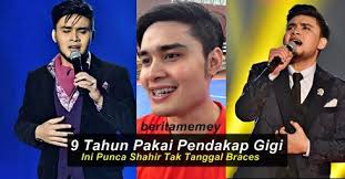 Ini Punca Shahir Tak Tanggal Braces Gigi Dah 9 Tahun Pakai Ini Punca Shahir Tak Tanggal Braces Gigi Dah 9 T Braces Incoming Call Screenshot Incoming Call
