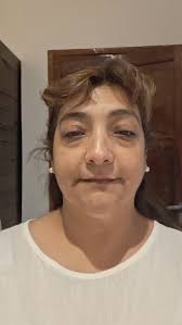 Tenes que regalarte esta limpieza profunda de cutis., Gracias a Las manos  MÁGICAS de @adanoelestetica Susana con toda la paciencia y su suavidad  logra lo que ningún desmaquillaste puede... dejarte la ...