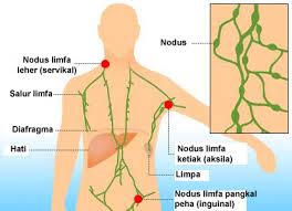 Apa itu kanser limfoma tanda tandanya. Tanda Kanser Limfoma Yang Kita Tidak Sedar Ladywankaydiary Com