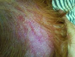 This is due to stomach acid aiding your ability to digest crucial nutrients and protein used in hair growth. Treating Your Dog S Hypothyroidism Whole Dog Journal