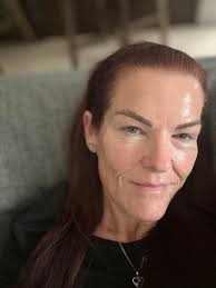 Alpha-H thinking about trying this for something different also I've read  so many positive comments