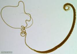 Image result for Whipworm