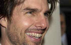 The australian society of orthodontists (aso) is the peak specialist body for orthodontists and orthodontic knowledge across australia. Metal Mouth Throwback Photos Of Celebs Before After Braces