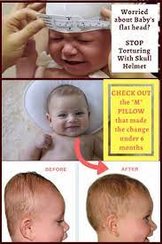 Baby Flat Head Pillow Picks Choose The Best For Your Baby Flat Head Pillow Flat Head Baby Baby Helmet