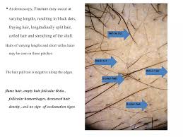 Image result for Hair Pull Test