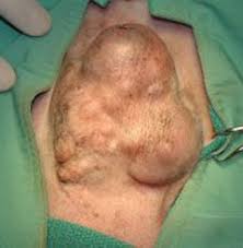 Dogs with inflammatory mammary carcinoma, a relatively rare subtype of. Crookwell Veterinary Hospital Animal Care Dogs Mammary Tumours