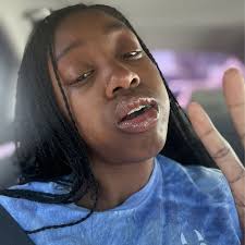 TOP 10 BEST Wisdom Teeth Removal No Insurance in Lewisville, TX