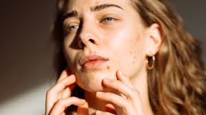 SWAN Skin Wellbeing and Nutrition (@swan.skin.nutrition) • Instagram photos  and videos