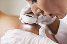 Unfortunately, when it shows up, it is often not recognized. Why Am I Having Surgery To Remove A Small Basal Cell Carcinoma