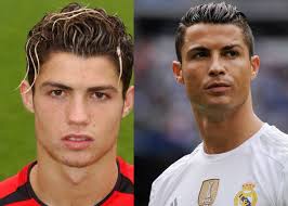 Ещё в ребячестве увлекся данным видом спорта. Krishtianu Ronaldu Do I Posle Plastiki Lica Foto Umnica Krasavica