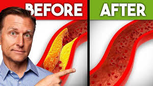 Want to support your heart health naturally?, Learn about 5 key nutrients  that can help unclog arteries and reduce plaque buildup., For more health  information you can't find anywhere else, click ...