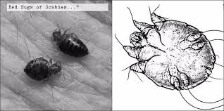 Image result for what does scabie look like