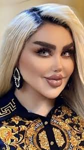 She had 43 cosmetic procedures to become a "REAL" Barbie Doll.