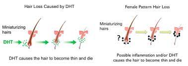 Adequate levels of t3 and t4 hormones cause the growth part of the hair follicle cycle to last longer, causing increased (normal) hair growth. Common Causes Of Hair Loss Trichostem Hair Regeneration Centers