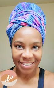 It is such a battle dealing with eczema, aging and unruly skin. Whether  it’s acne, dry patches, or wrinkles, sometimes it seems like your skin just  won’t listen. Maybe it's what you are eating, ...