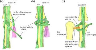 Image result for Elson Extensor Tendon Test