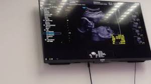 Check spelling or type a new query. 2d Detail Scan Sekali Dah Nampak Gender Youtube