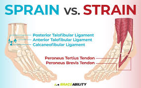 Ranges of motion exercisesare also important for rehabilitation. A Sprain A Twist Or A Roll Decipher Your Ankle Injury