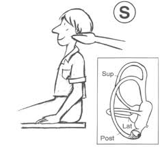 Image result for Canalith Repositioning Procedure