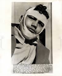 1955 Press Photo Raul Macias bantamweight jaw boxer