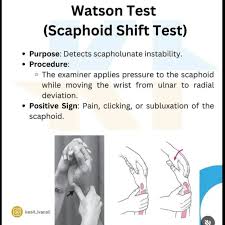 Image result for Scaphoid Shift Test