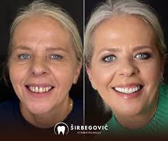 Širbegović Stomatologija