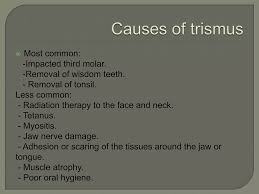 Image result for Trismus