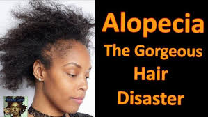 Even though hair loss is common among black women, more than 81 percent of respondents said they had never consulted a doctor about it. Hair Loss Treatments For Black Women Home Facebook